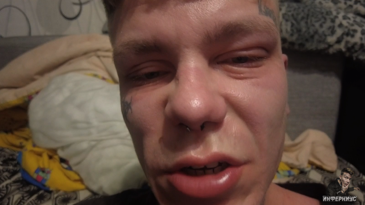 Я в момент аллергии 