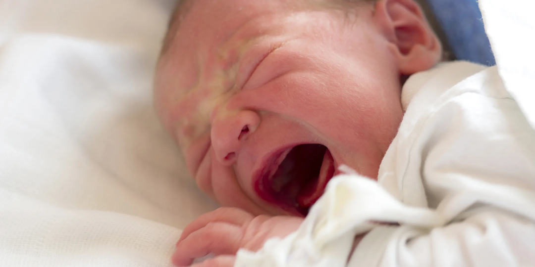 Врожденный сифилис – возможно ли такое сегодня и чем это опасно для плода