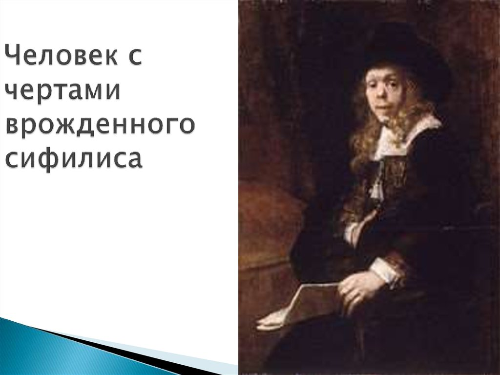 Как выглядит человек болеющий сифилисом