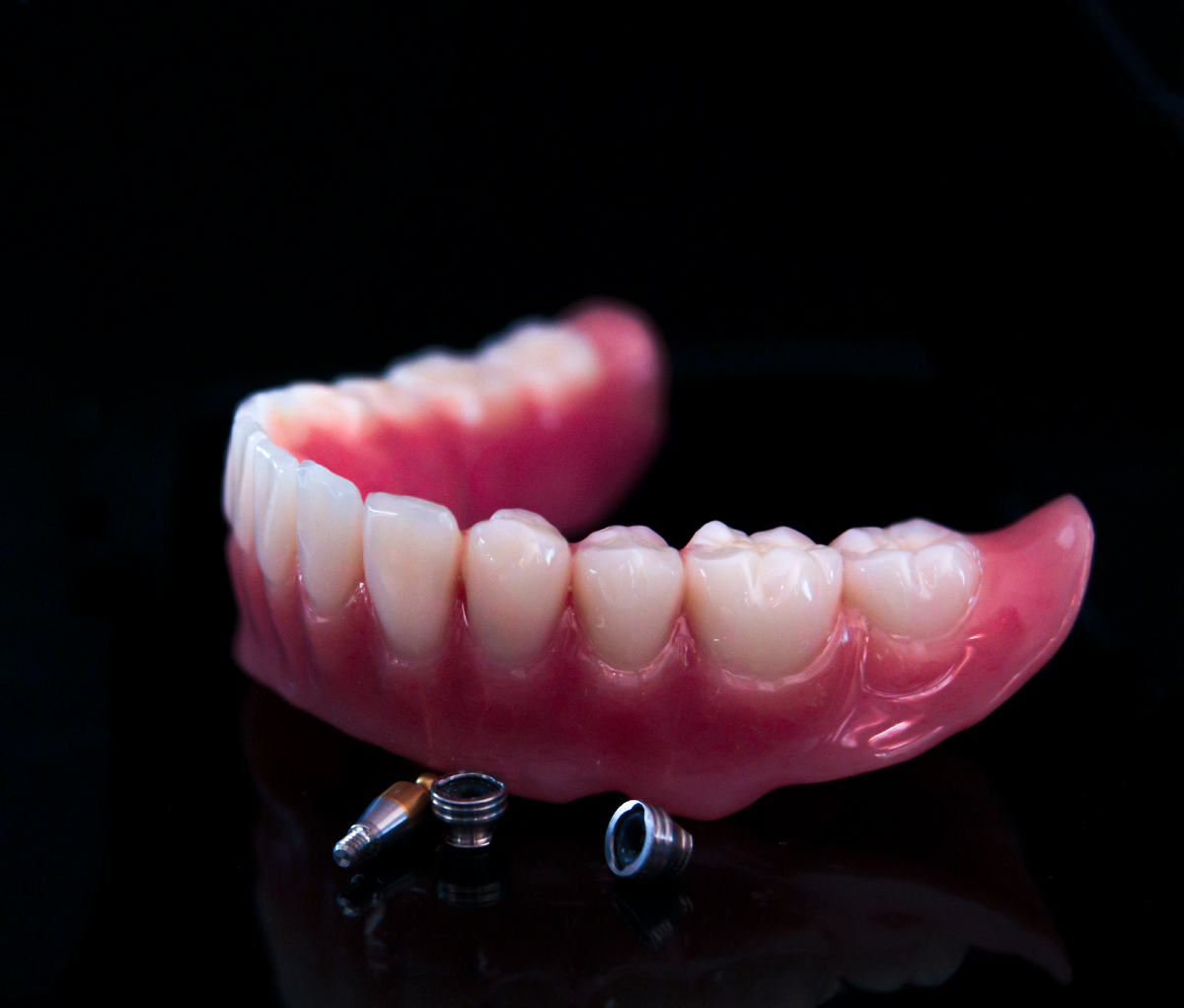 Акриловый съемный протез с гарнитурными зубами Tribos, в данном случае - на шаровидных абатментах (на нескольких имплантатах).