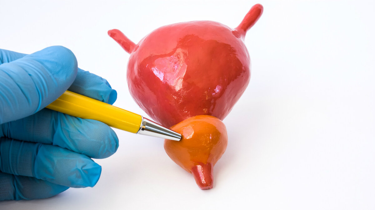 Предстательная железа