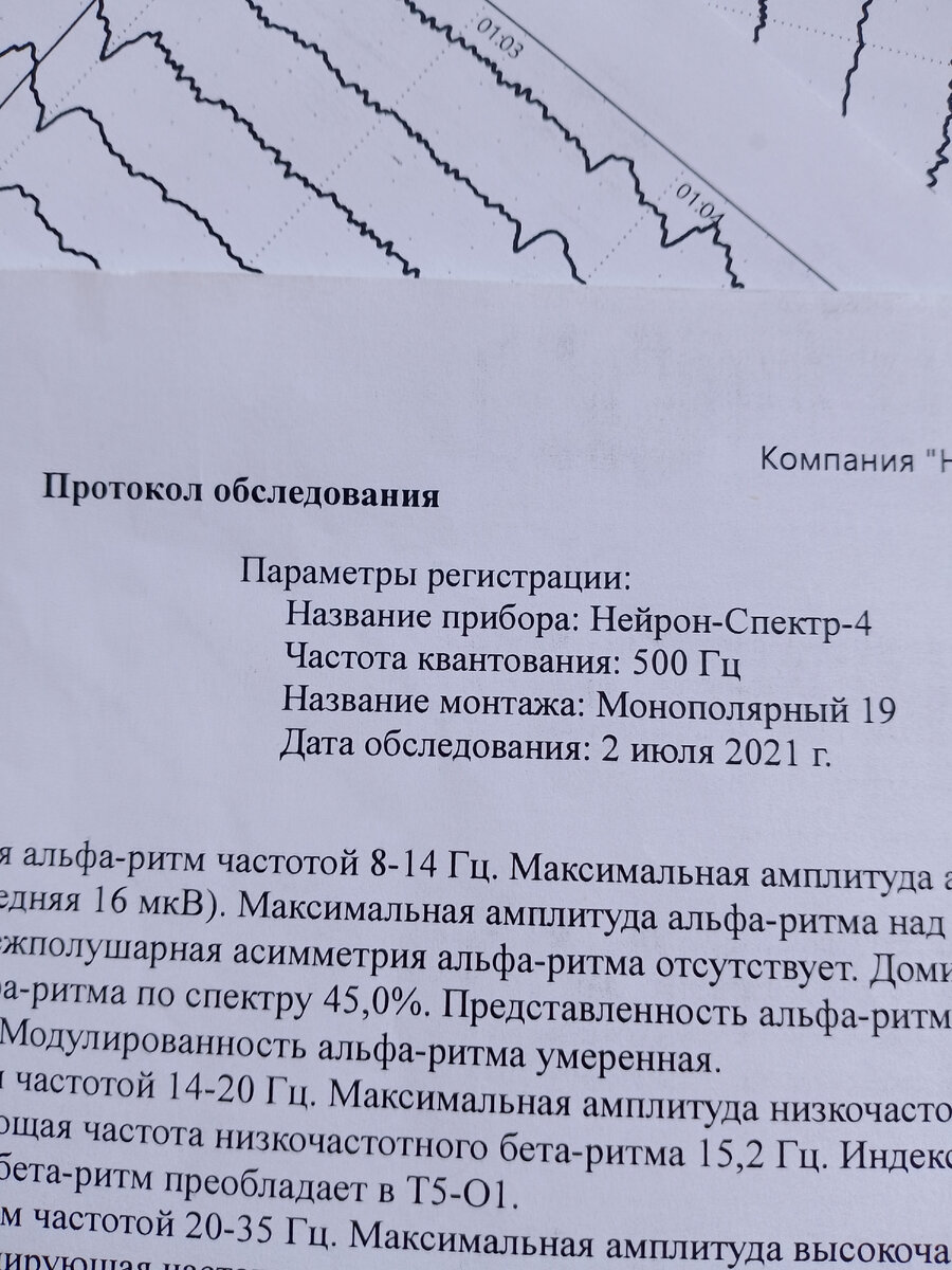 Как я в больницу ходил и старые деньги. | Бывший Алкаш и Копарь. | Дзен