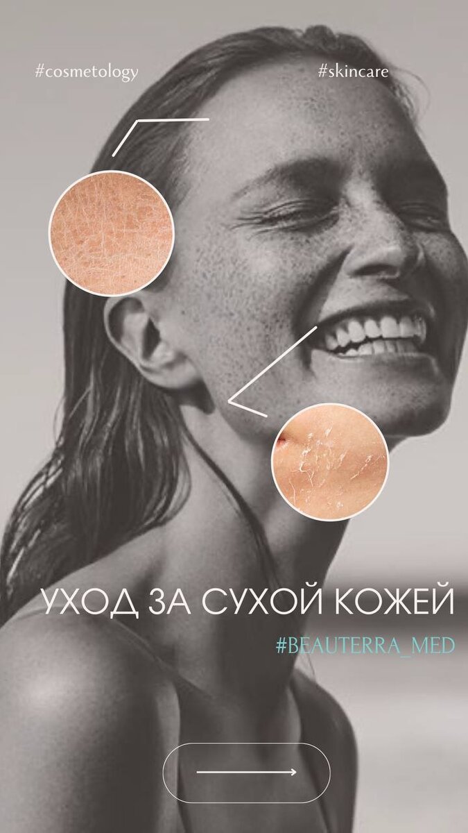 Уход за сухой кожей от косметологов клиники BEAUTERRA