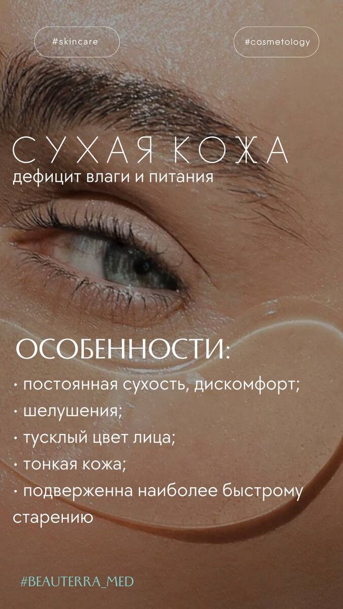 Признаки сухой кожи подборка от косметологов БЬЮТЕРРА