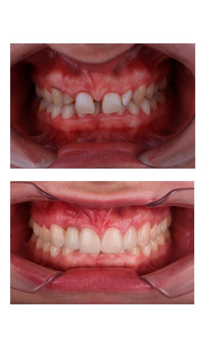 Вверху - до лечения, внизу - после лечения