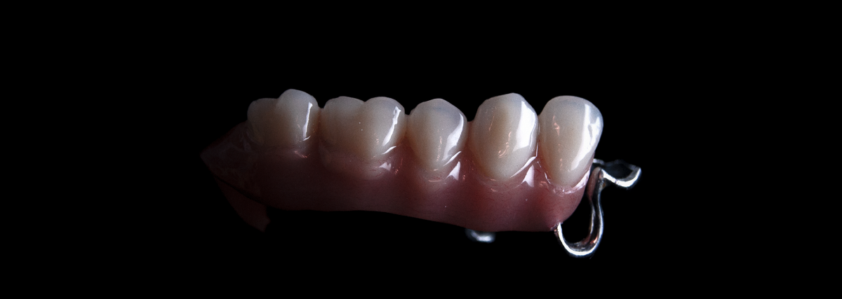 Бюгельный протез, частичный, с гарнитурными зубами Tribos.
