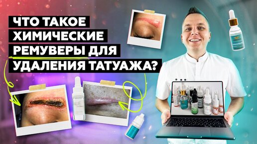 Download Video: Скачивай БЕСПЛАТНЫЙ ГАЙД «Как выбрать свой первый лазер для лазерного удаления ПМ и тату?» по ссылке 👉🏻 https://clck.ru/352Pw4