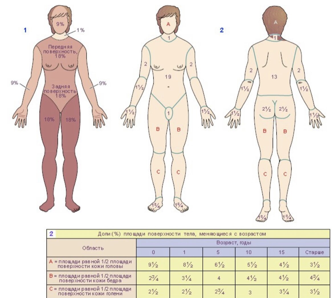 Процент поверхности тела. Таблица Ланда и Броудера. Схема Ланда и Броудера. Схема площадь ожога. Схема определения площади ожогов.