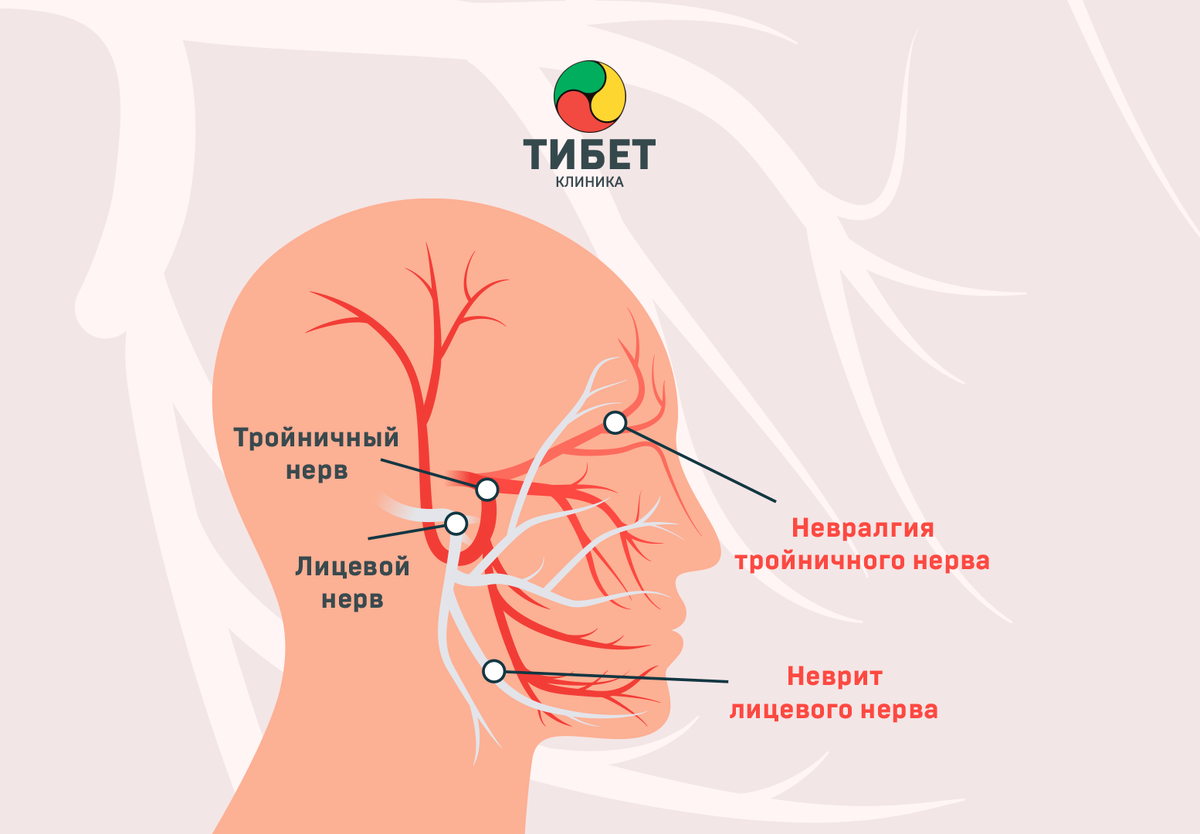 Воспаление лицевого нерва – почему возникает? | Клиника «Тибет» | Дзен