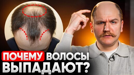 Как остановить выпадение волос и вновь отрастить волосы? Причины облысения у мужчин