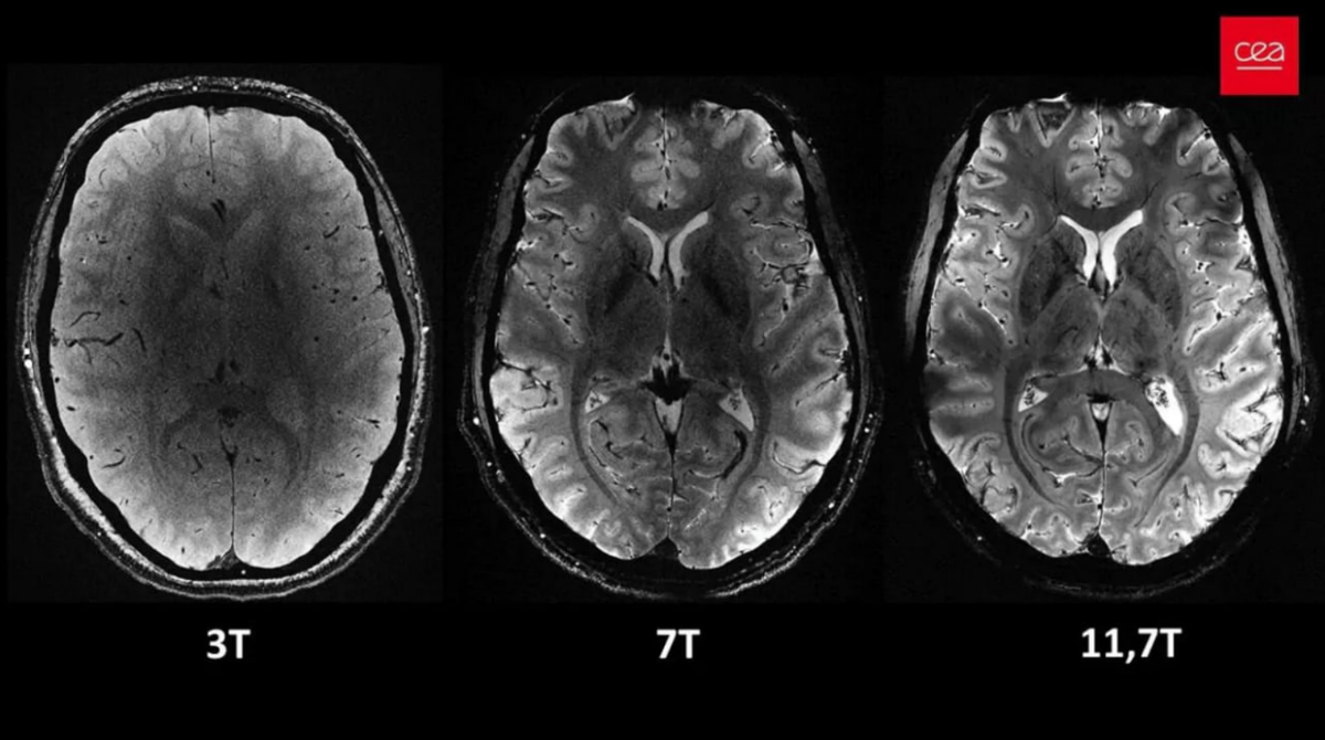 🧠 Представлен самый мощный в мире МРТ-сканер, который совершит прорыв в  медицине | Технологии, которые меняют мир | Дзен