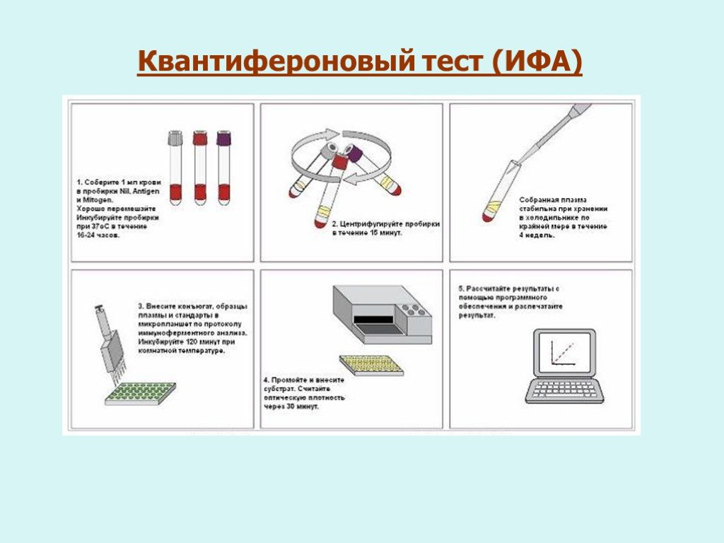 Диагностика туберкулеза – проба Манту, Диаскинтест и квантифероновый тест –  что лучше? | О детском здоровье: с врачебного на родительский | Дзен