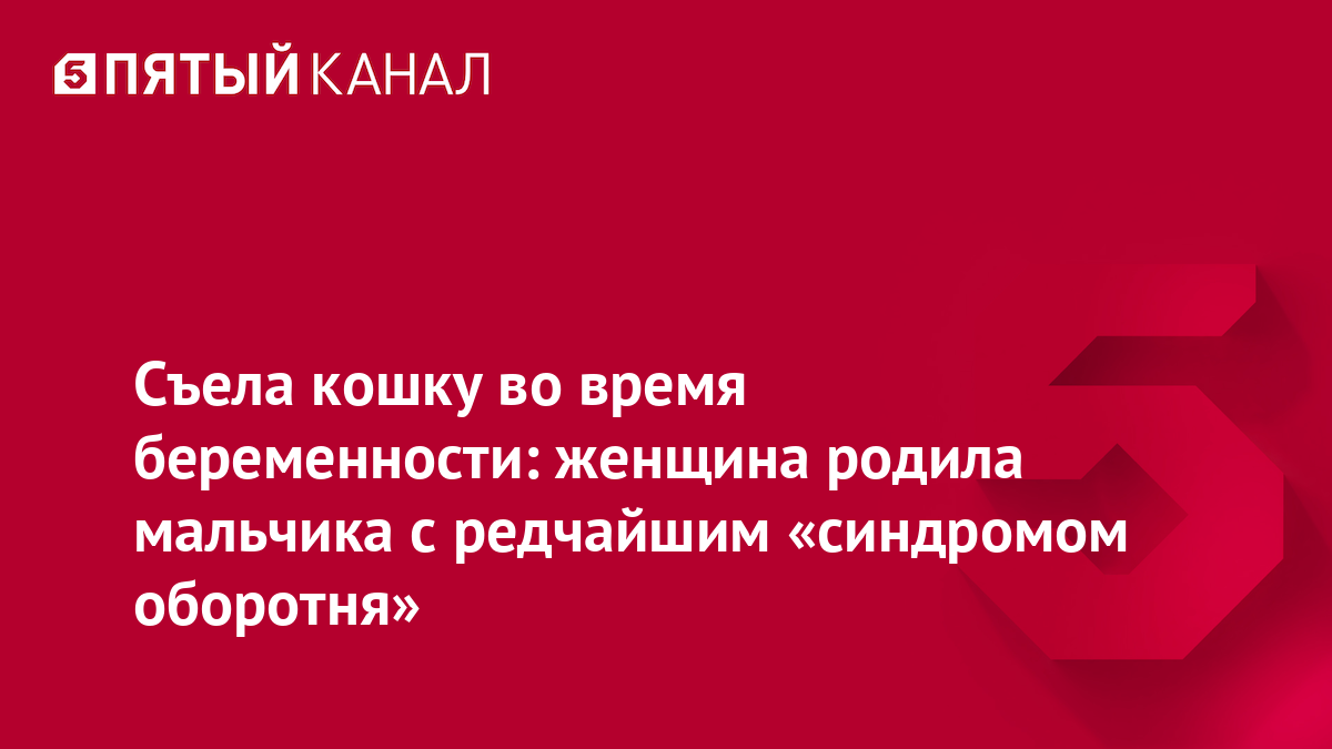 Съела кошку во время беременности: женщина родила мальчика с редчайшим  «синдромом оборотня» | Пятый канал - новости и видео | Дзен