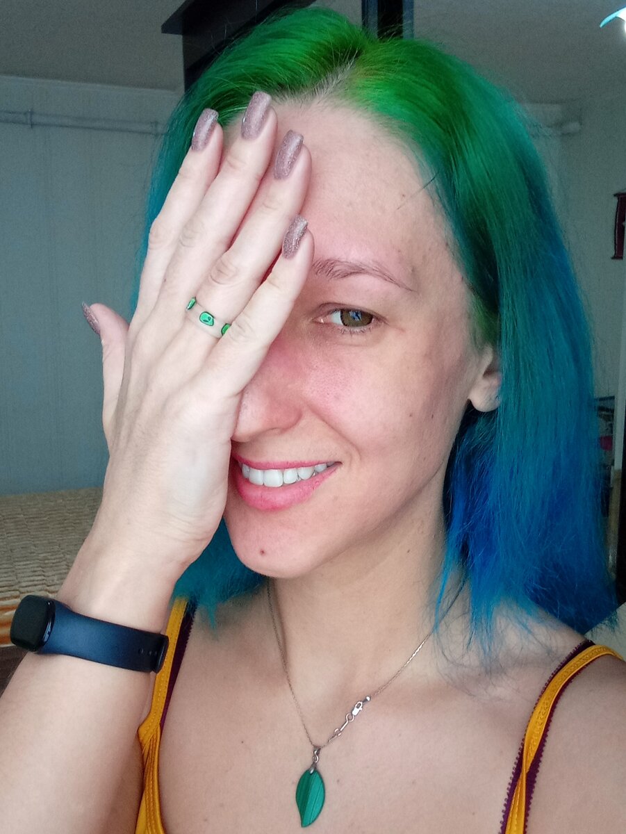 Фото без ретуши. Прикрыла рукой, чтобы было не такое жуткое фото.