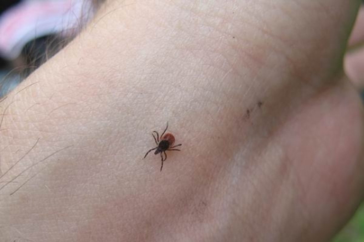    Жители Татарстана начали обращаться в больницы с укусами клещей