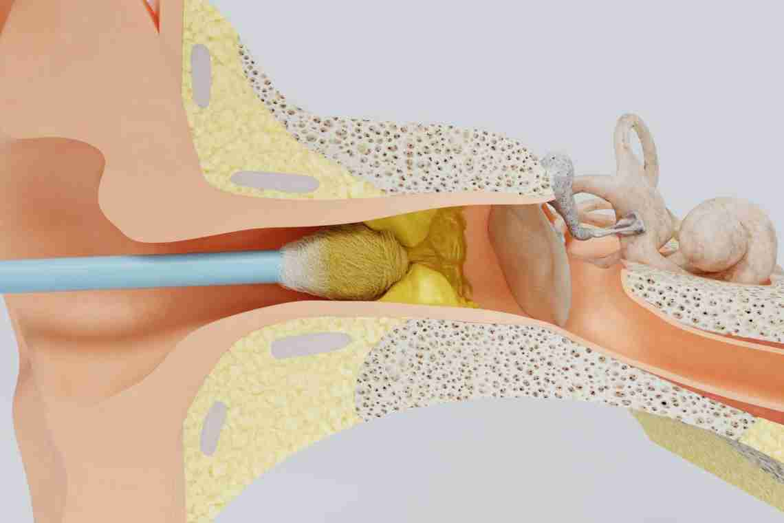 ᐈ Откуда берется ушная пробка и что делать если много серы в ушах?