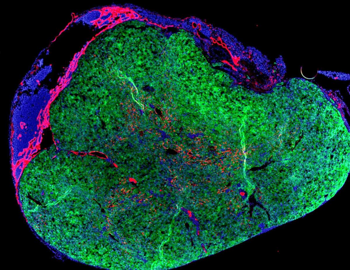 «Мини-печень», выращенная из клеток печени в лимфатическом узле мыши