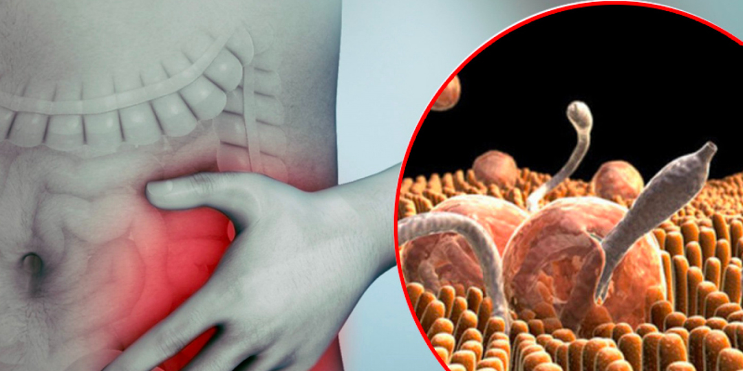 Виды паразитов в организме: определит ли их анализ и насколько опасны разные виды