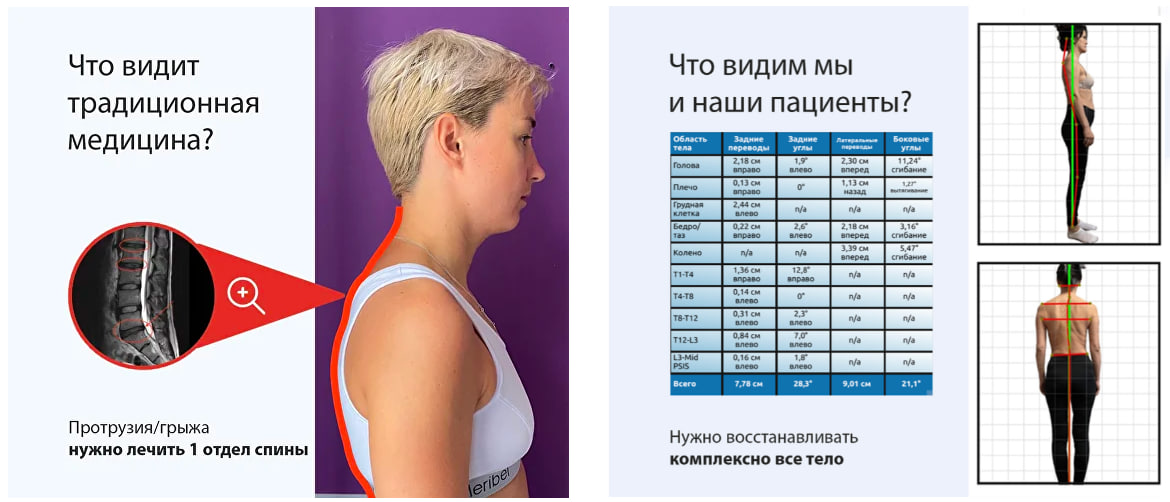 Как на вас смотрит традиционная медицина и специалисты нашего центра оздоровления позвоночника