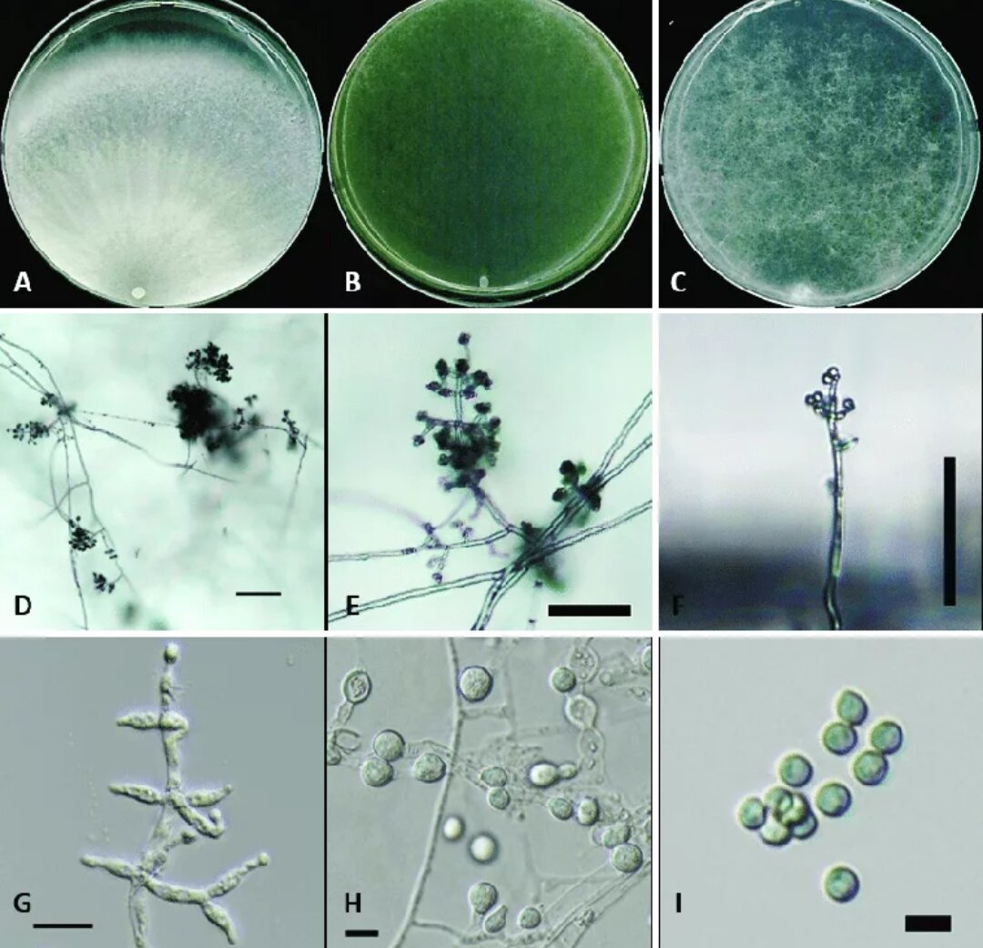 Триходерма 