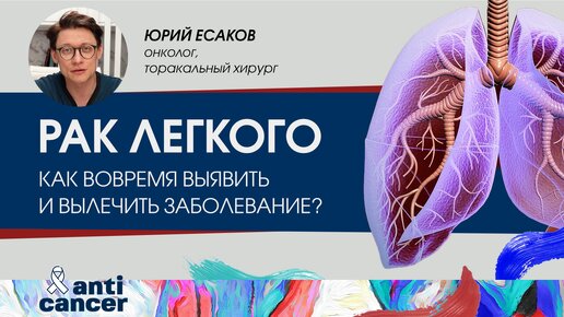 Рак легкого. Как вовремя выявить и вылечить заболевание?