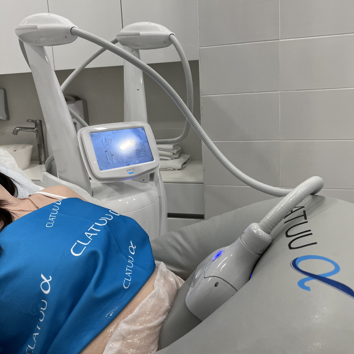 Процедура криолиполиз Clatuu | косметология GEN87