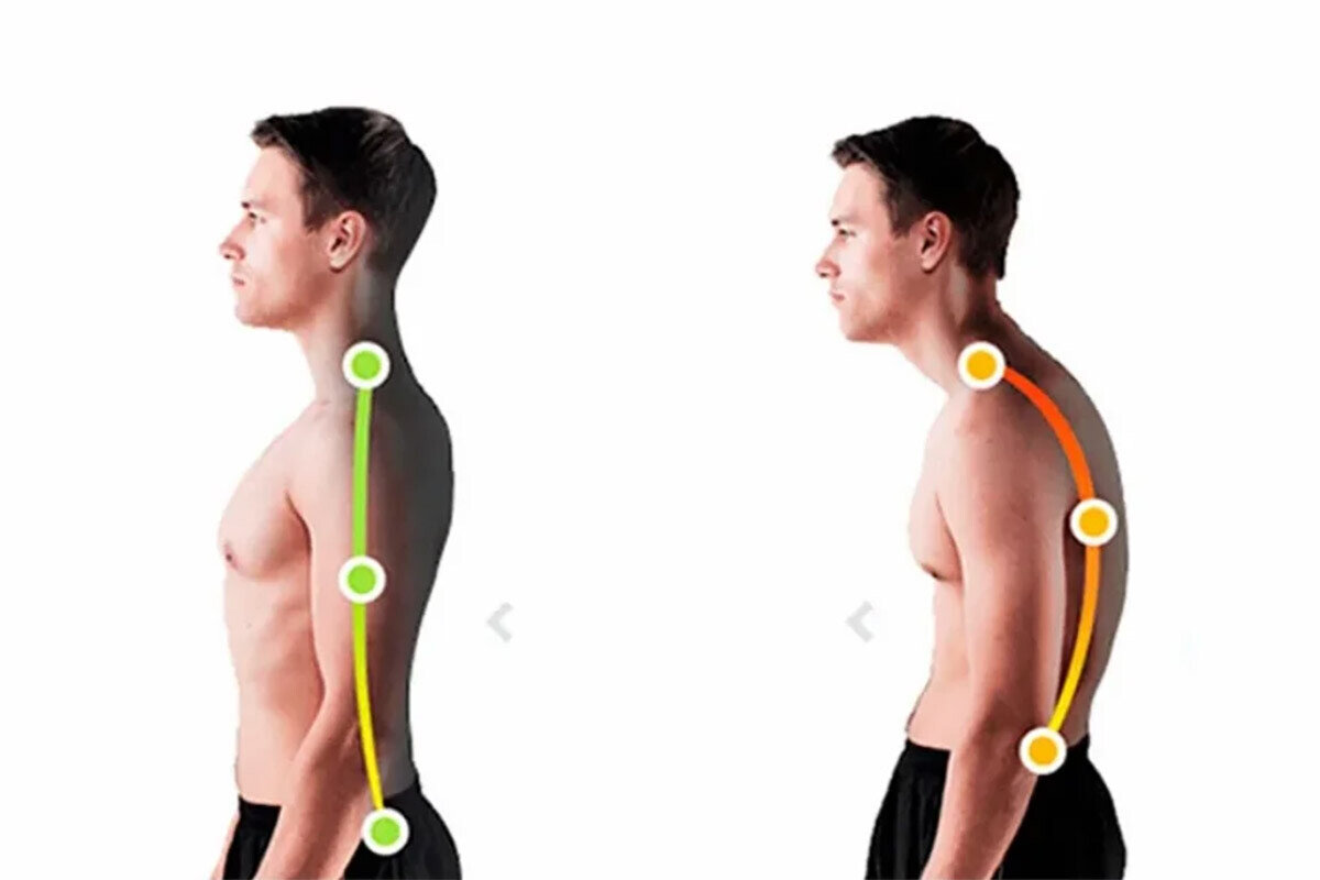 Круглая спина. Осанка. Сутулость. Ровная осанка.