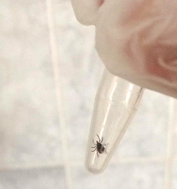    В Урае у ребенка обнаружили клеща