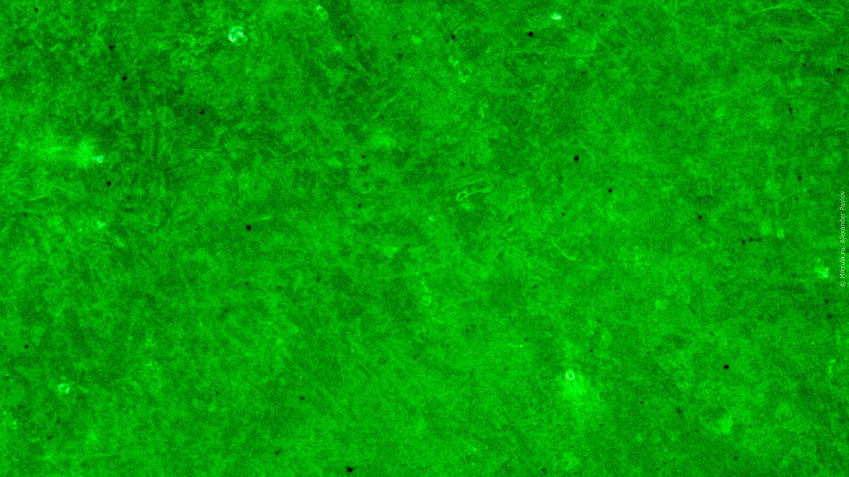 Увеличение ×200