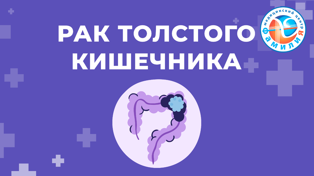 Рак толстого кишечника – это злокачественная опухоль, сформированная из атипичных эпителиальных клеток нижних отделов пищеварительной системы.