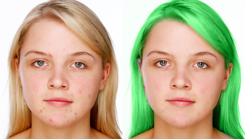 Задание на уроке по PhotoShop — провести косметические процедуры на лице. Отметьте лайком, у кого лучше получилось 😊
Мне больше понравилось последняя картинка.
