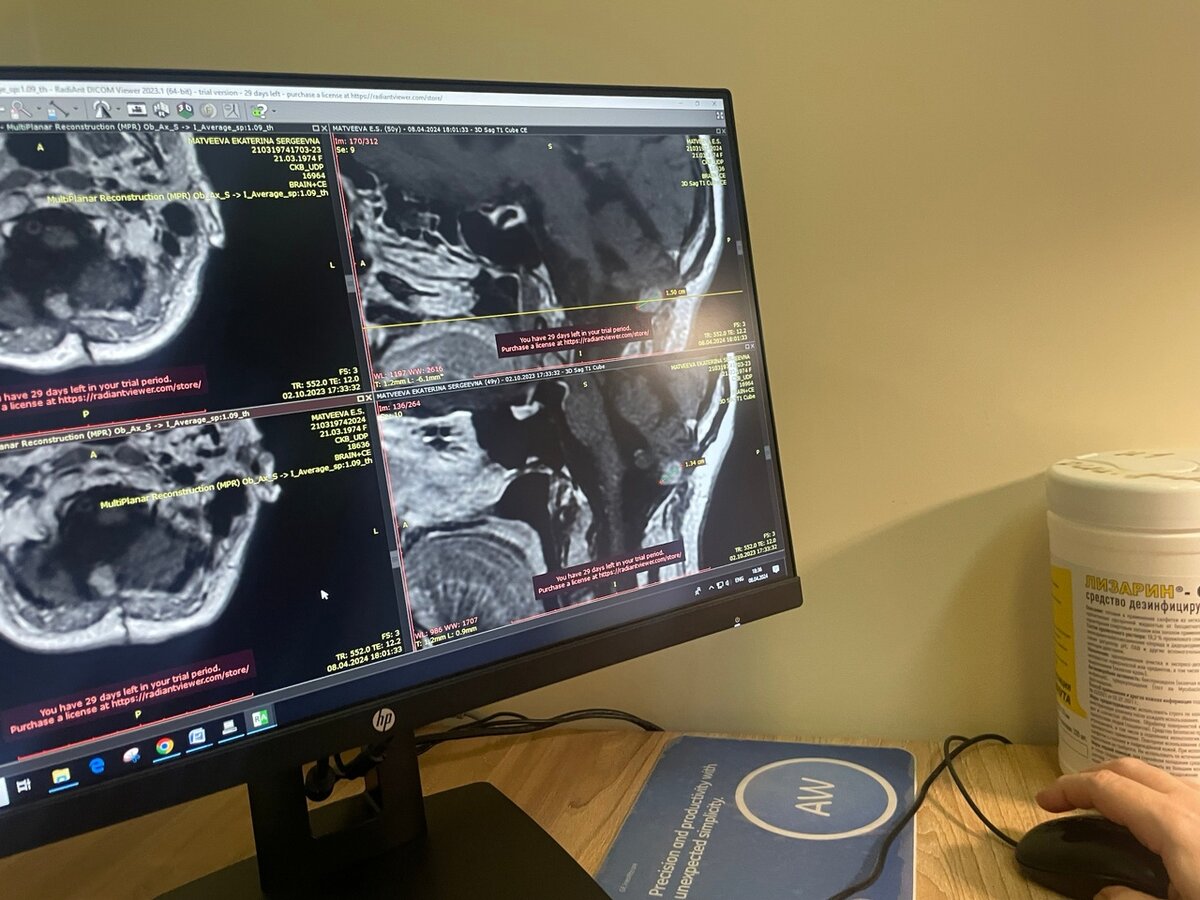 Подробнее о результатах МРТ. Что с моим рецидивом. И чего не разрешил  доктор. | Екатерина (Мама Мира) Матвеева | Дзен