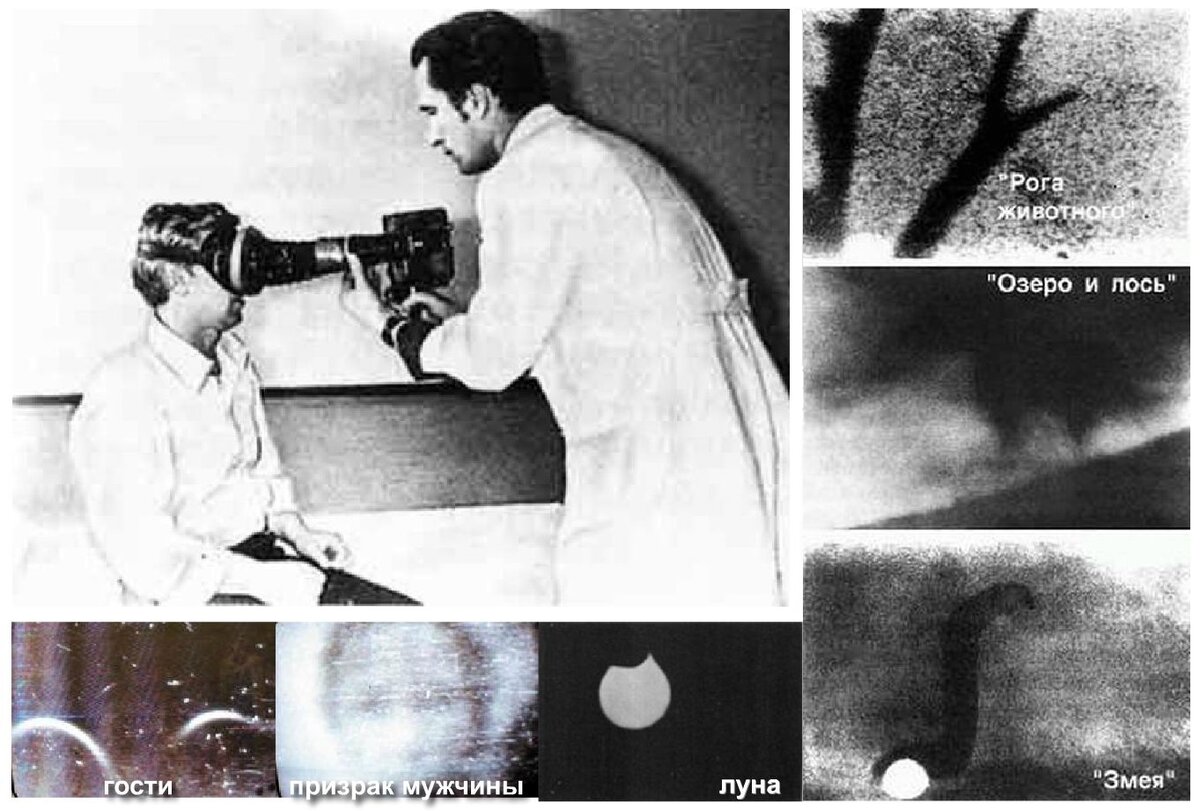 Крохалев зафиксировал излучение из глаз пациентов