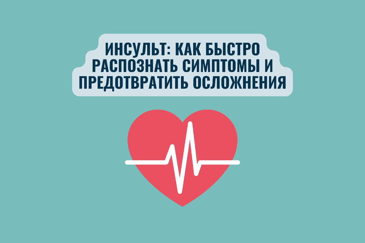 Инсульт: как быстро распознать симптомы и предотвратить осложнения |  Терапевты против ОРВИ | Дзен