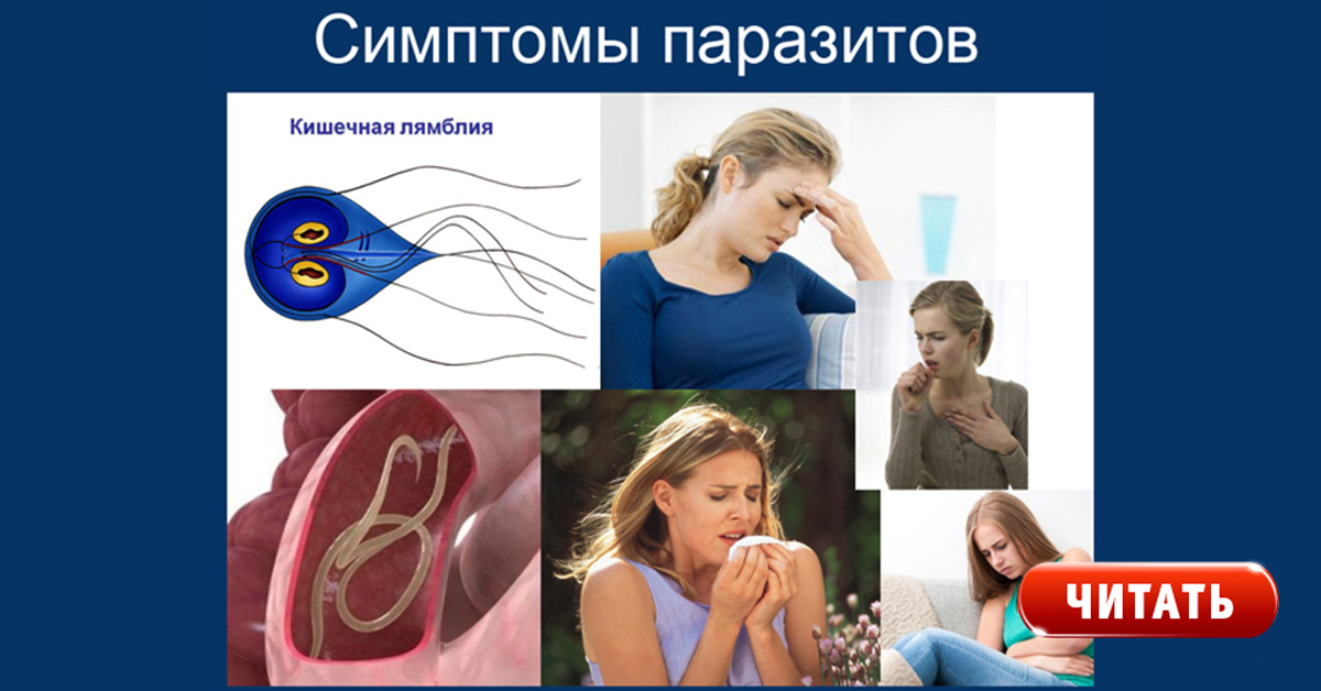 Симптомы если у человека глисты. Симптомы наличия паразитов у человека. Симптомы глистов в организме человека. Признаки наличия глистов в организме человека.