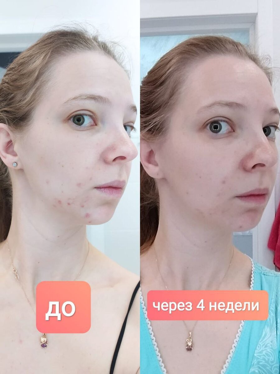 Потрясающий эффект "налицо"! Без комментариев, как мне кажется ))