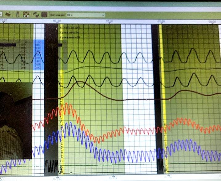 Непрерывная синхронная запись динамики физиологических процессов (полиграмма)