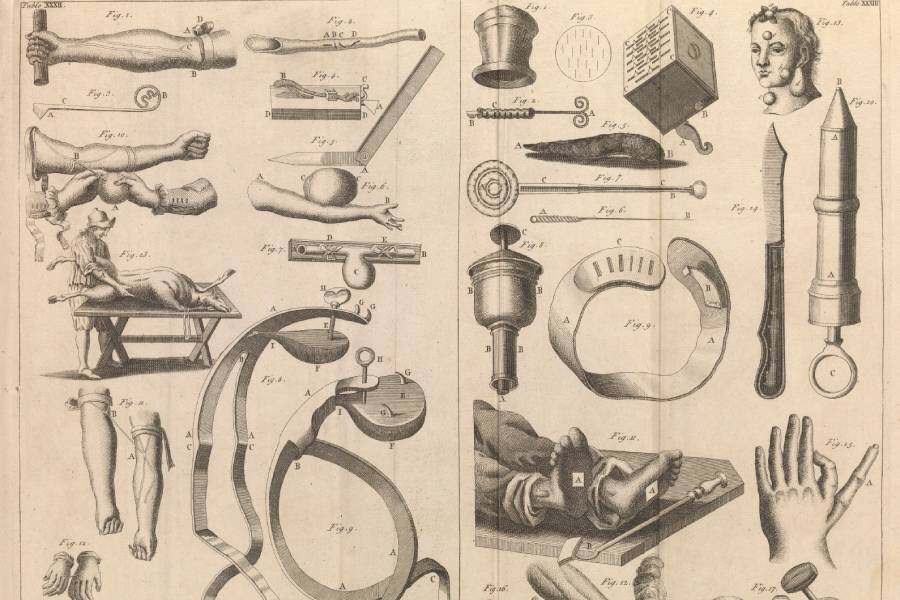 Медицинский словарь, 1743 год. Методы переливания крови. Иллюстрация вен и лигатуры большой аневризмы руки, переливания крови животного человеку и переливания из руки в руку или из рук в руки Фото: Wellcomeimages.com