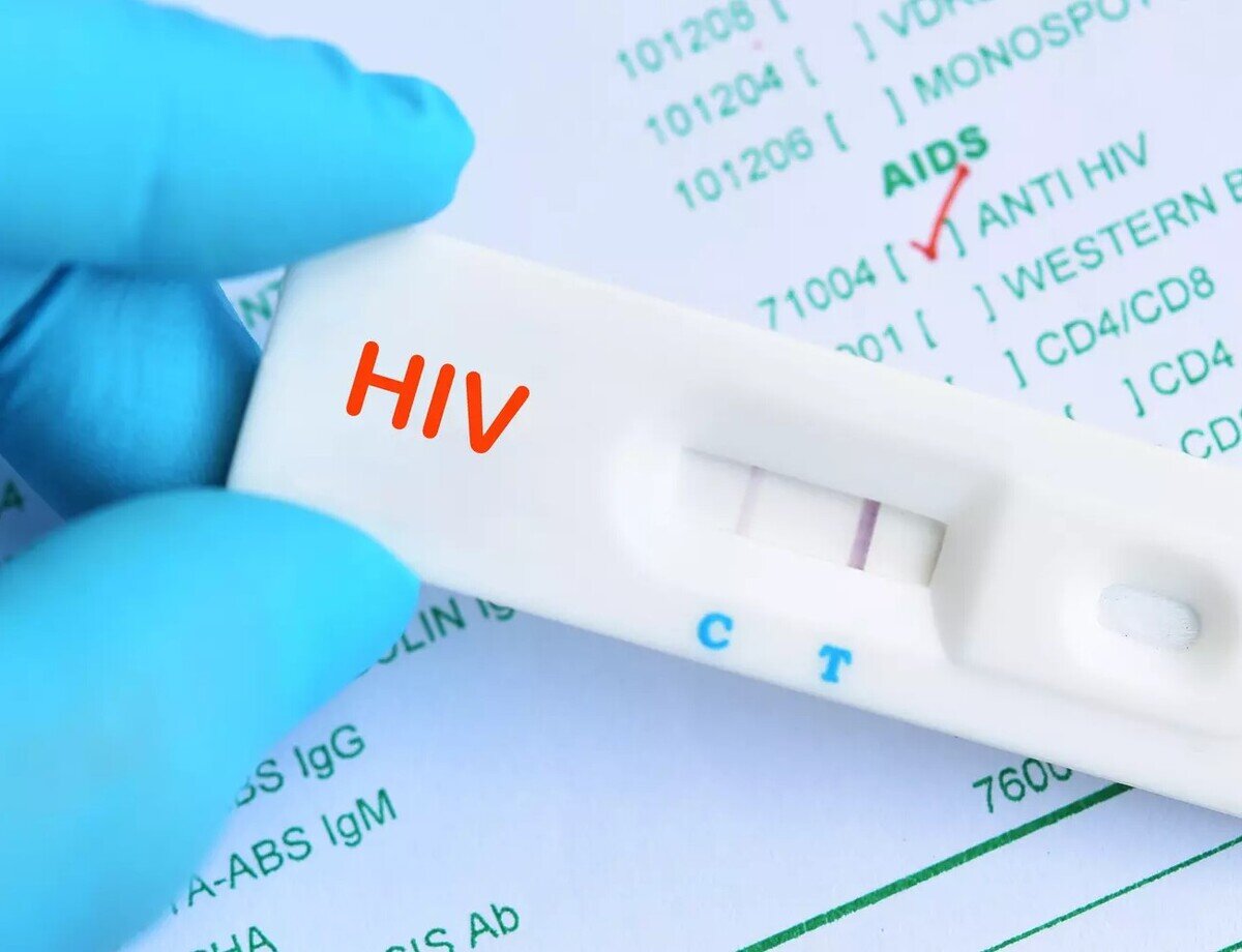Экспресс-тест на ВИЧ