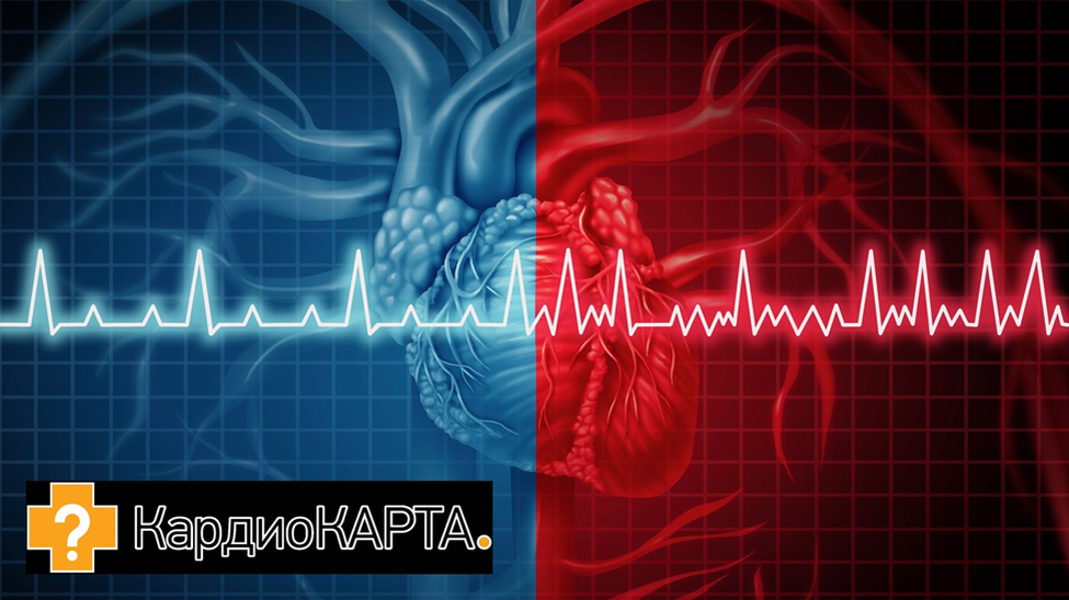 Что делать дома с мерцательной аритмией? Или жизнь после больницы ...