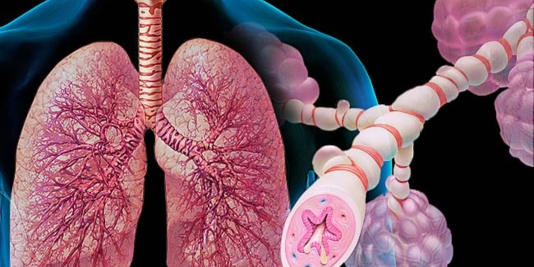 Бронхиальная астма или ХОБЛ: по каким симптомам их можно различить и зачем это нужно?