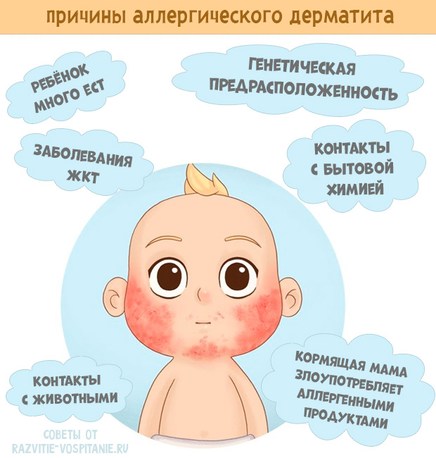 Причины атопического дерматита у взрослых фото