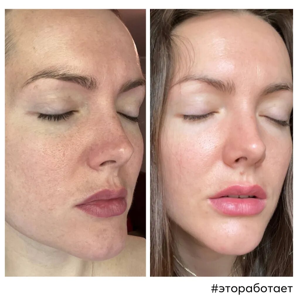 Архив Skinjestique