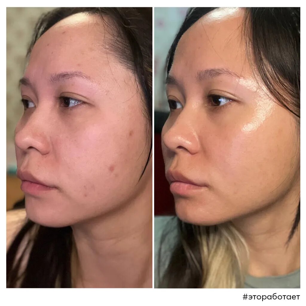 Архив Skinjestique