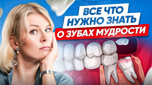 Download Video: 6 вещей, которые НЕЛЬЗЯ делать ДО, и ПОСЛЕ удаления зуба мудрости