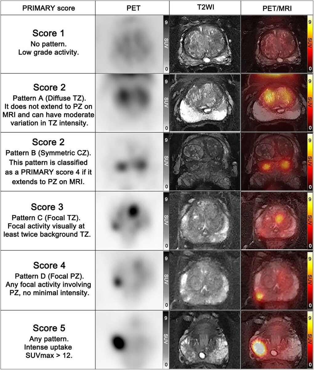   Jingyan Shi et al. / Journal of Nuclear Medicine, 2024