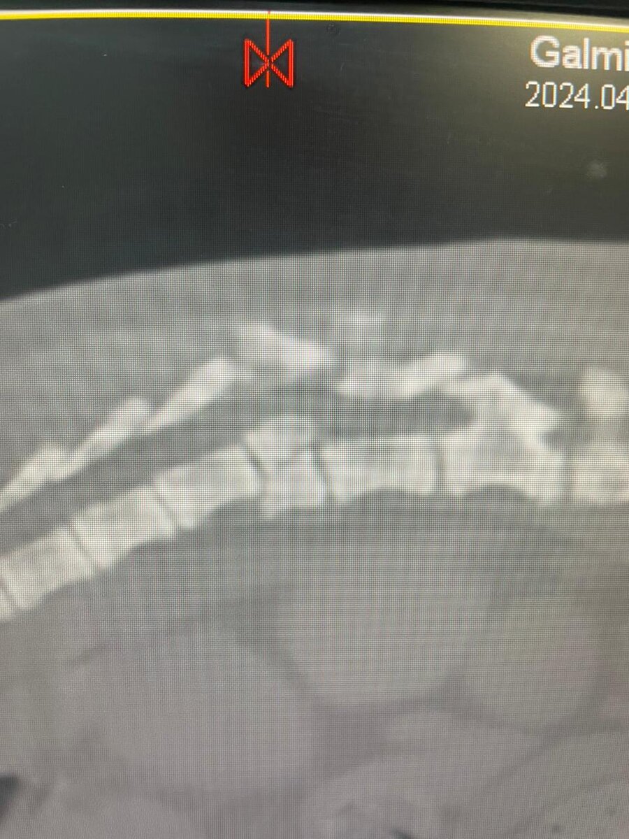 Снимок КТ позвоночника Снежки
