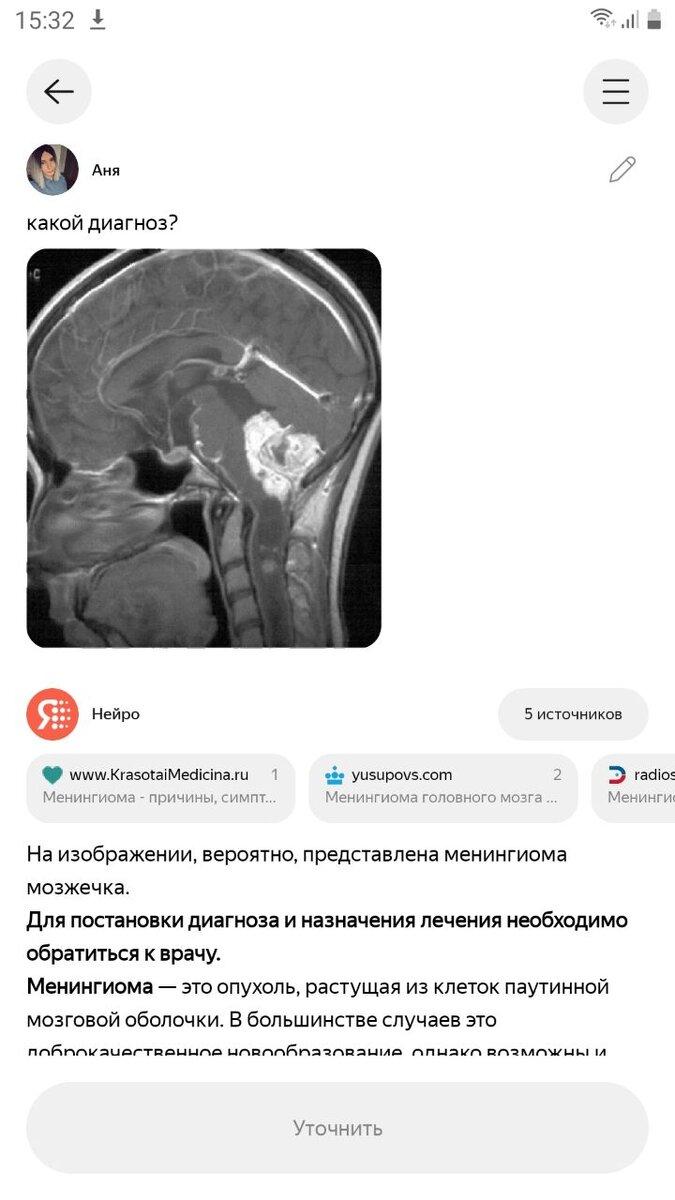 Ого. Пойду свои снимки МРТ перепроверять. Эта из сети