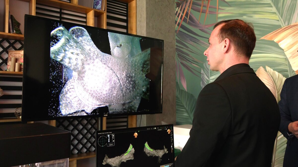    В Югре учатся делать 3D-карту сердца