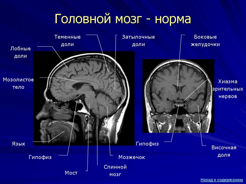 Мр сигнал в лобной доле